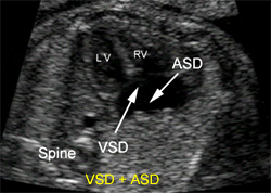 Real-Time B-Mode Ultrasound